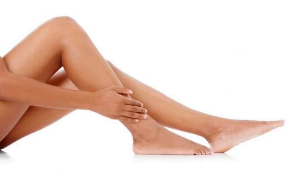 Varices recomendaciones