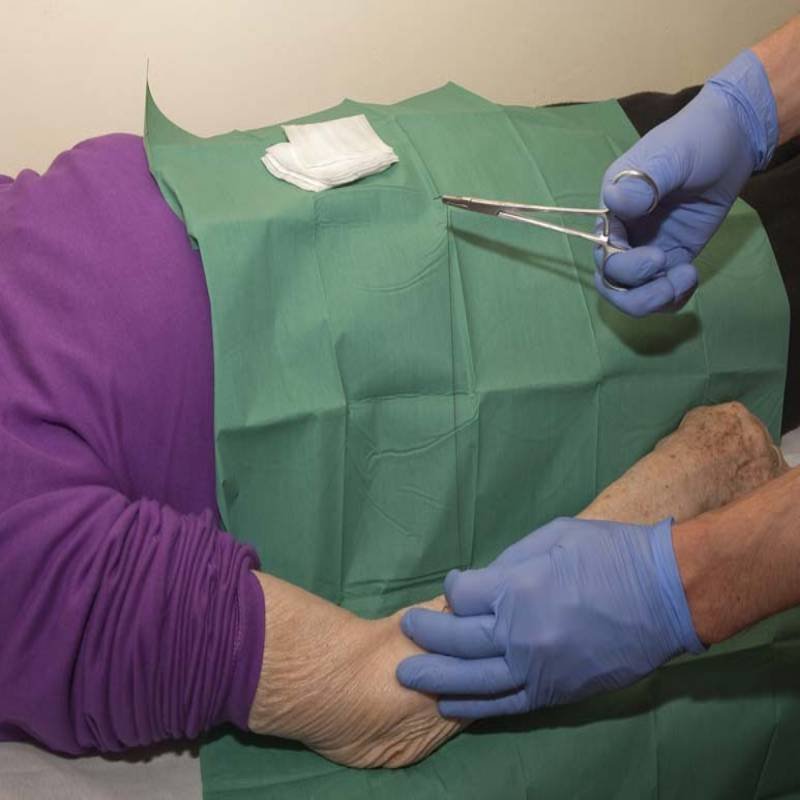 heridas crónicas y agudas.