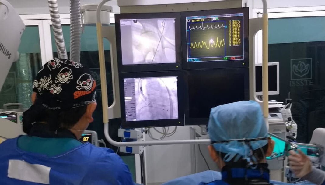 Colocan en el Issste válvula aórtica percutánea pórtico en paciente Colocan en el Issste válvula aórtica percutánea pórtico en paciente