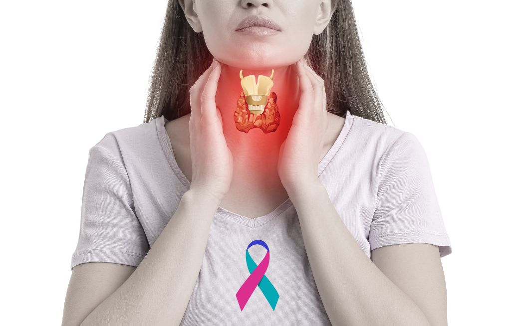 Cáncer de tiroides, el segundo detrás del de mama Cáncer de tiroides, el segundo detrás del de mama