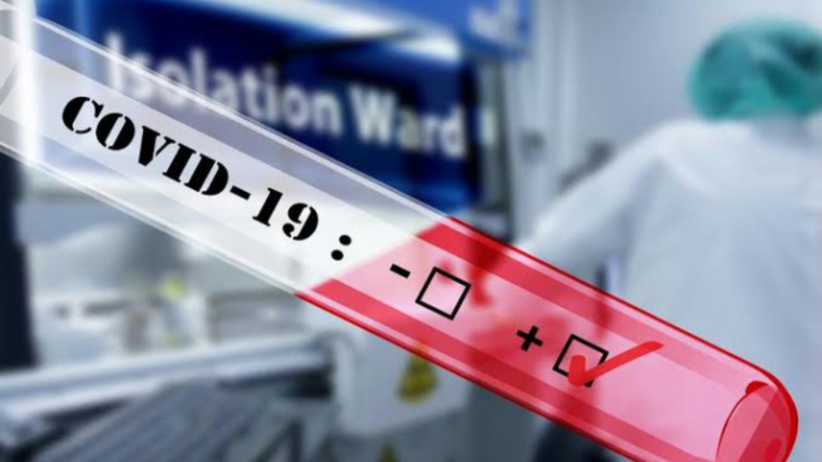 Confirma Salud 170 nuevos casos de COVID-19 Confirma Salud 170 nuevos casos de COVID-19