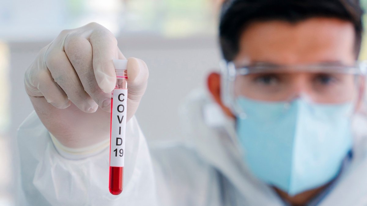 Puebla, con 728 personas hospitalizadas por covid-19