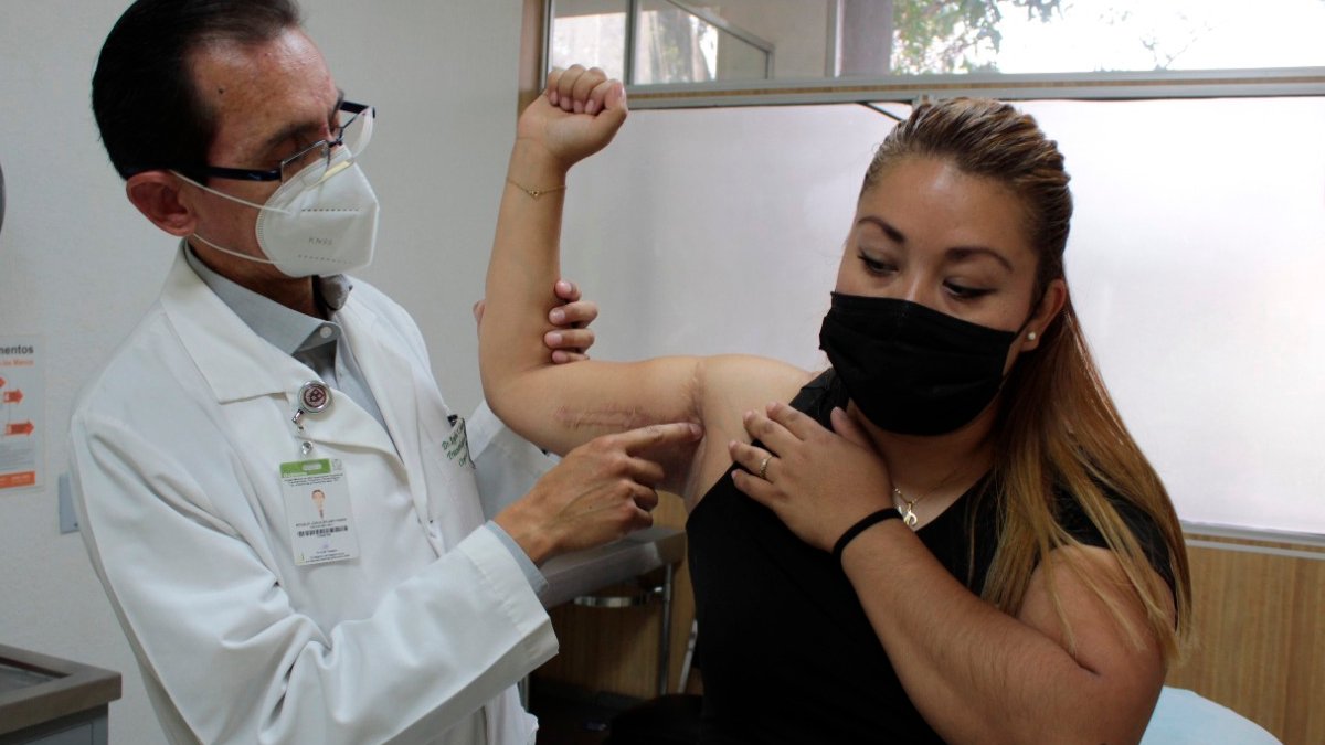 IMSS logra que mujer recupere 90% de movilidad del brazo tras recibir bala perdida IMSS logra que mujer recupere 90% de movilidad del brazo tras recibir bala perdida