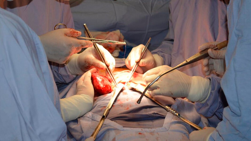 Suma ISSSTEP cuatro trasplantes de riñón en el año Suma ISSSTEP cuatro trasplantes de riñón en el año