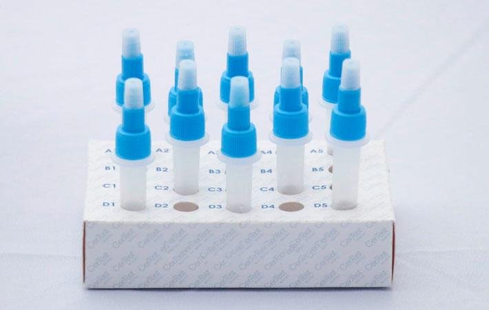 Puebla, con 14 personas hospitalizadas por dengue y 332 casos activos de COVID-19