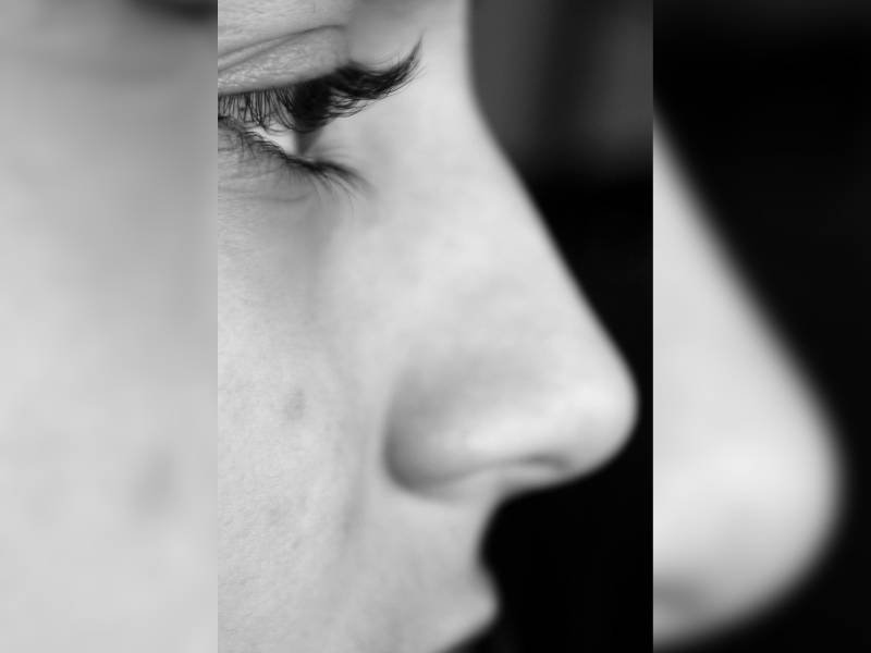 que es la rinoplastia