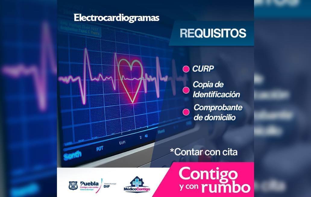 electrocardiograma