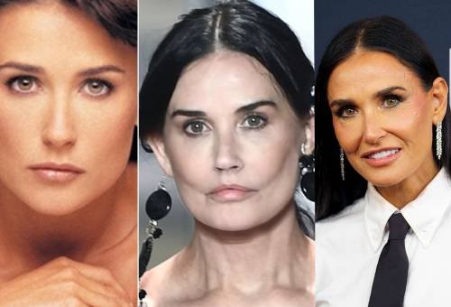 Hollywood y las cirugías estéticas de los famosos