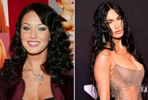 Hollywood y las cirugías estéticas de los famosos