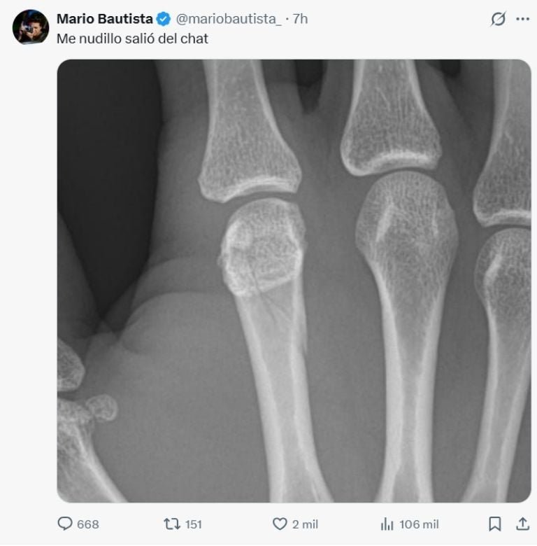 combate entre Aarón Mercury y Mario Bautista.