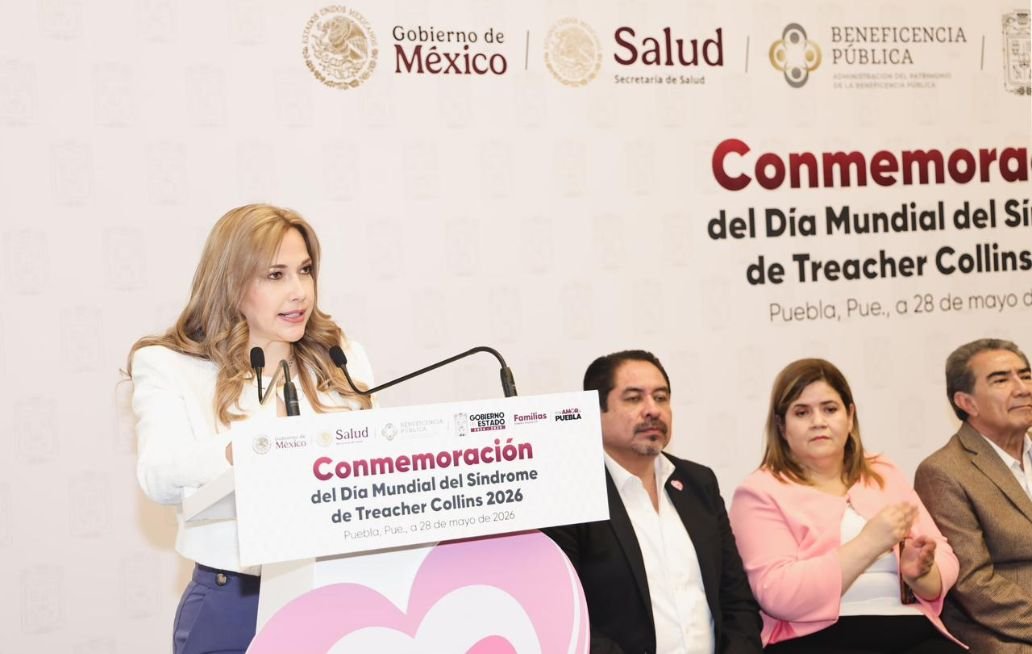SEDIF y Beneficencia Pública Nacional transforman vidas de niñas y niños con Síndrome de Treacher Collins SEDIF y Beneficencia Pública Nacional transforman vidas de niñas y niños con Síndrome de Treacher Collins