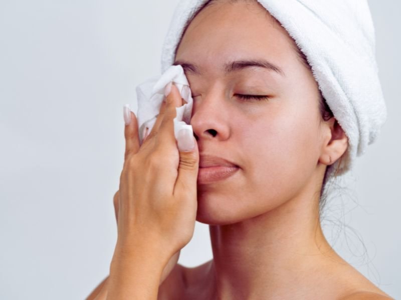 parches para el acne