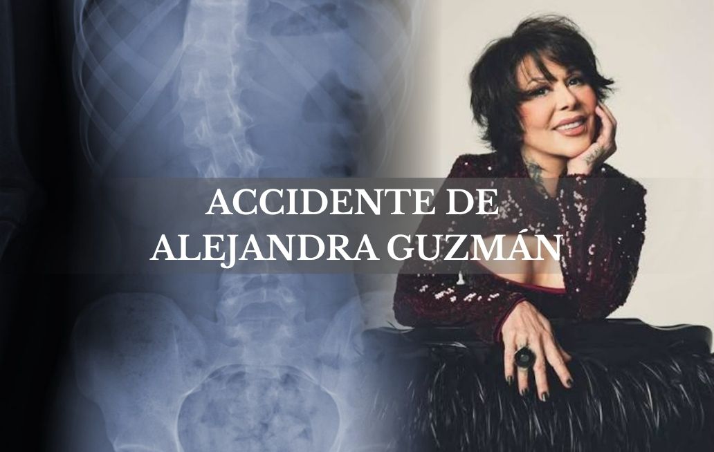 Alejandra Guzmán: ¿Qué diagnóstico recibió tras su accidente en Veracruz? Alejandra Guzman
