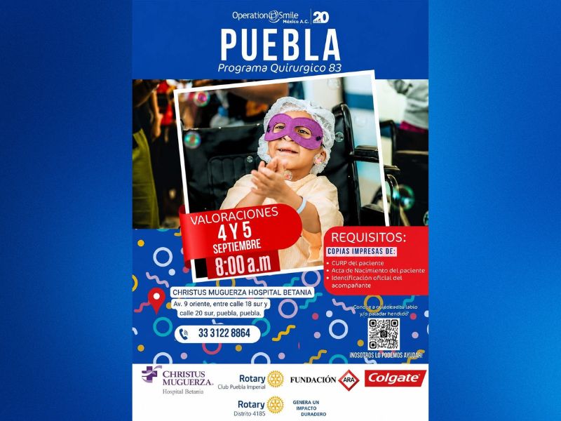 Operation Smile México realizará cirugías gratuitas de labio y paladar hendido
