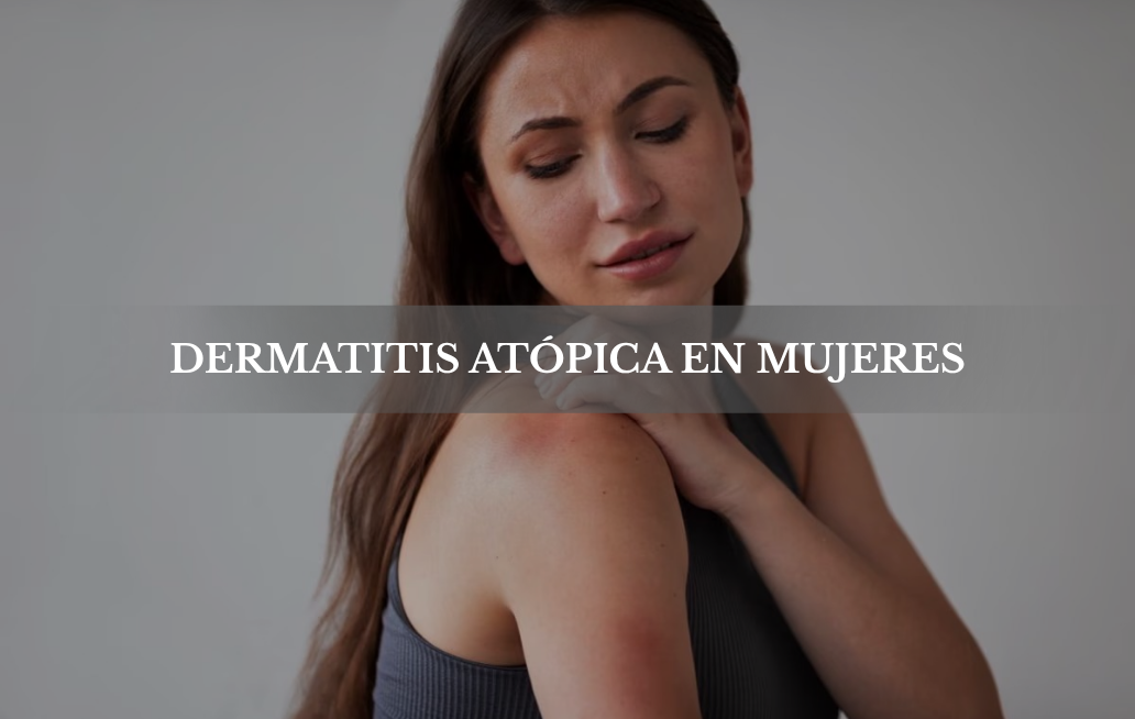 DERMATITIS